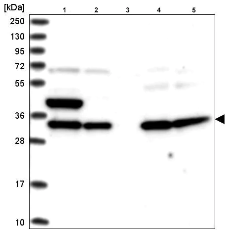 Western blot - Anti-SPG21/Maspardin antibody (AB220229)
