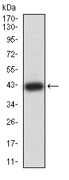 Western blot - Anti-SPG3A/ATL1 antibody [1F6B12] (AB233646), expandable thumbnail