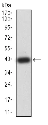 Western blot - Anti-SPG3A/ATL1 antibody [1F6B12] (AB233646)