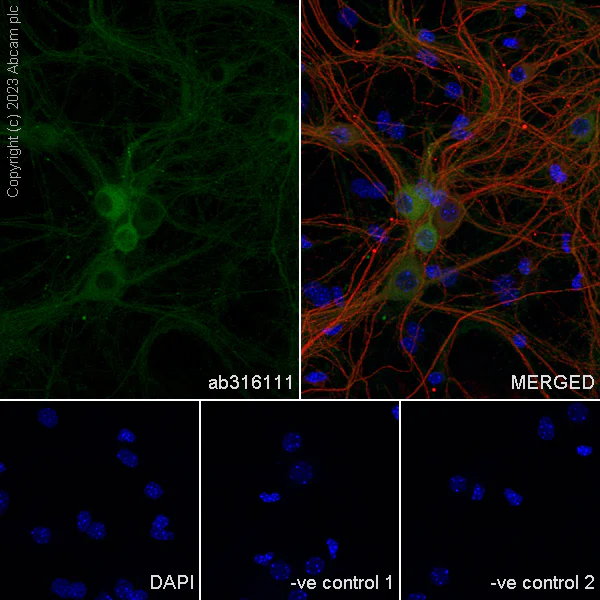 Immunocytochemistry/ Immunofluorescence - Anti-SPG3A/ATL1 antibody [EPR28057-64] (AB316111)
