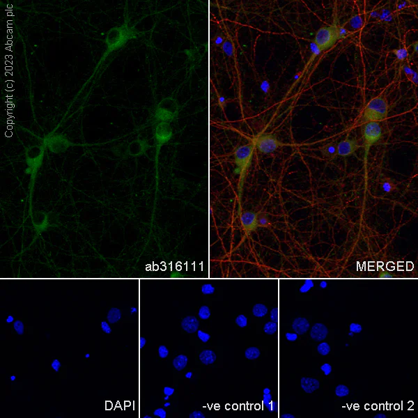 Immunocytochemistry/ Immunofluorescence - Anti-SPG3A/ATL1 antibody [EPR28057-64] (AB316111)