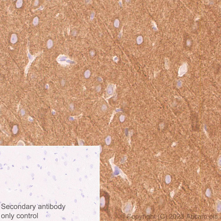Immunohistochemistry (Formalin/PFA-fixed paraffin-embedded sections) - Anti-SPG3A/ATL1 antibody [EPR28057-64] (AB316111)