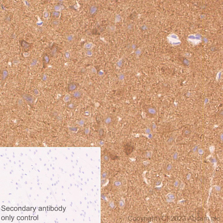 Immunohistochemistry (Formalin/PFA-fixed paraffin-embedded sections) - Anti-SPG3A/ATL1 antibody [EPR28057-64] (AB316111)