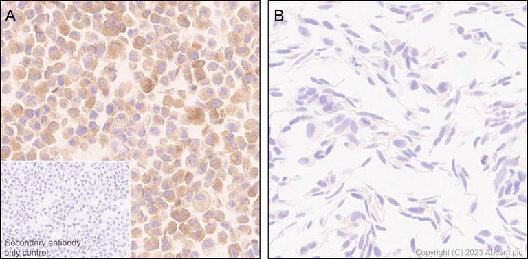 Immunohistochemistry (Formalin/PFA-fixed paraffin-embedded sections) - Anti-SPG3A/ATL1 antibody [EPR28057-64] (AB316111)