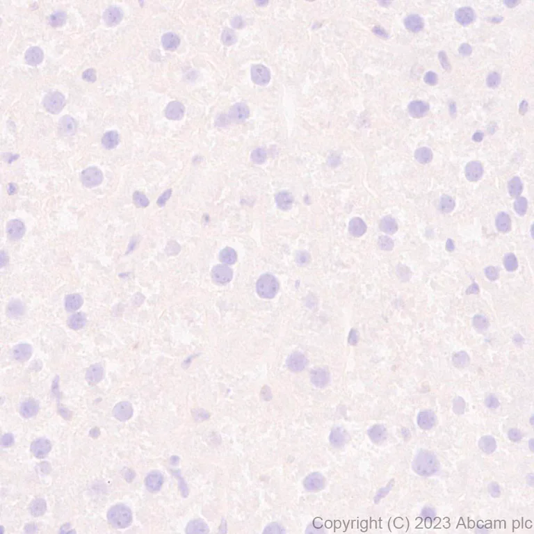 Immunohistochemistry (Formalin/PFA-fixed paraffin-embedded sections) - Anti-SPG3A/ATL1 antibody [EPR28057-64] (AB316111)