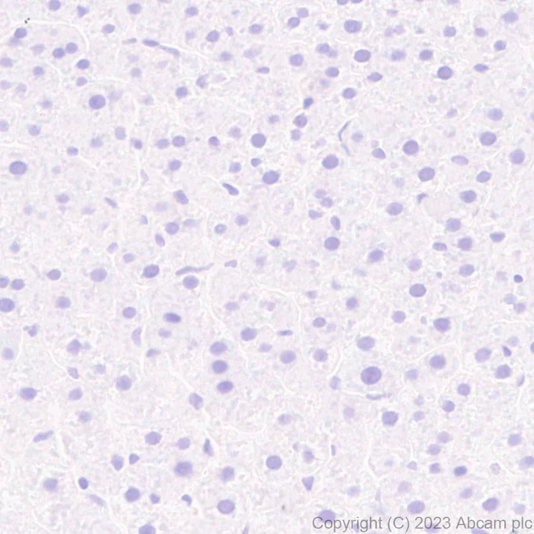 Immunohistochemistry (Formalin/PFA-fixed paraffin-embedded sections) - Anti-SPG3A/ATL1 antibody [EPR28057-64] (AB316111)