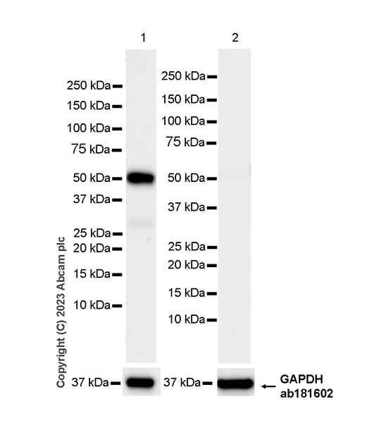 Western blot - Anti-SPG3A/ATL1 antibody [EPR28057-64] (AB316111)