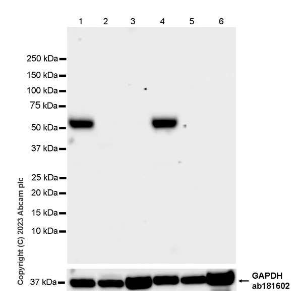 Western blot - Anti-SPG3A/ATL1 antibody [EPR28057-64] (AB316111)