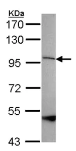 Western blot - Anti-SPG7/PGN antibody (AB96213)