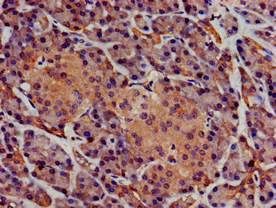 Immunohistochemistry (Formalin/PFA-fixed paraffin-embedded sections) - Anti-Sphingomyelin Synthase 1 antibody (AB235057), expandable thumbnail
