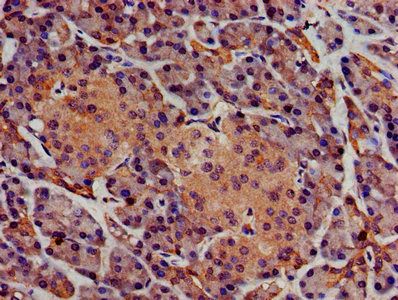 Immunohistochemistry (Formalin/PFA-fixed paraffin-embedded sections) - Anti-Sphingomyelin Synthase 1 antibody (AB235057)