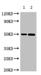 Western blot - Anti-Sphingomyelin Synthase 1 antibody (AB235057)