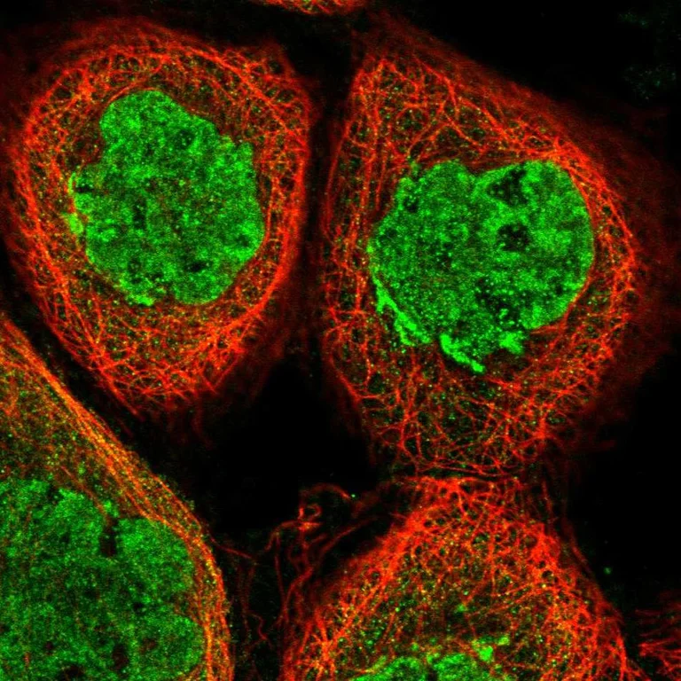 Immunocytochemistry/ Immunofluorescence - Anti-Sphingomyelin Synthase 1 antibody (AB247063)