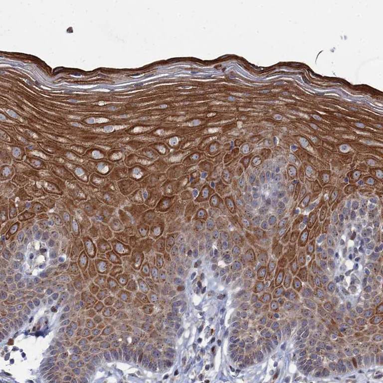 Immunohistochemistry (Formalin/PFA-fixed paraffin-embedded sections) - Anti-Sphingomyelin Synthase 1 antibody (AB247063)