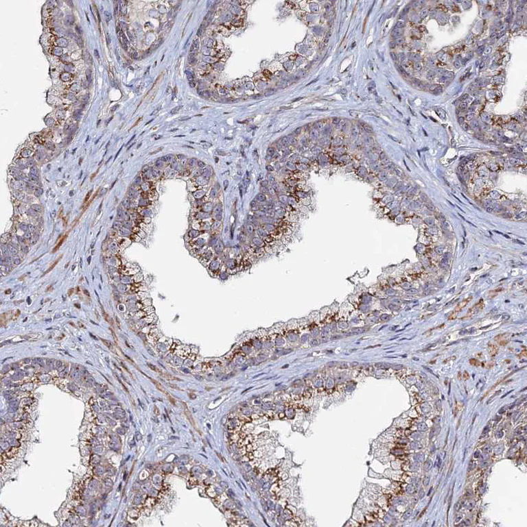 Immunohistochemistry (Formalin/PFA-fixed paraffin-embedded sections) - Anti-Sphingomyelin Synthase 1 antibody (AB247063)