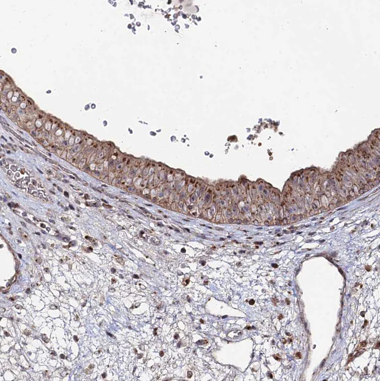 Immunohistochemistry (Formalin/PFA-fixed paraffin-embedded sections) - Anti-Sphingomyelin Synthase 1 antibody (AB247063)