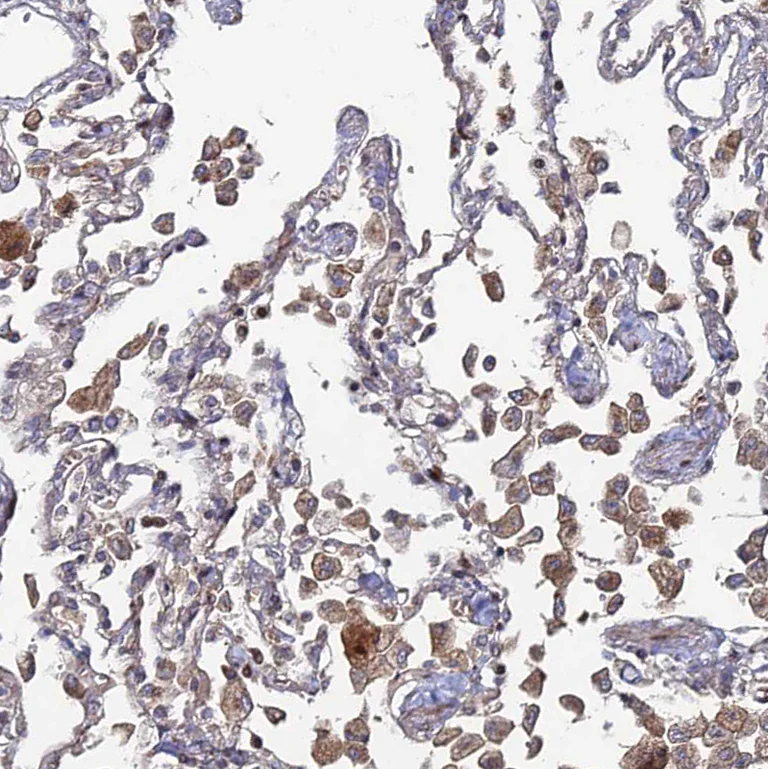 Immunohistochemistry (Formalin/PFA-fixed paraffin-embedded sections) - Anti-Sphingomyelin Synthase 1 antibody (AB247063)