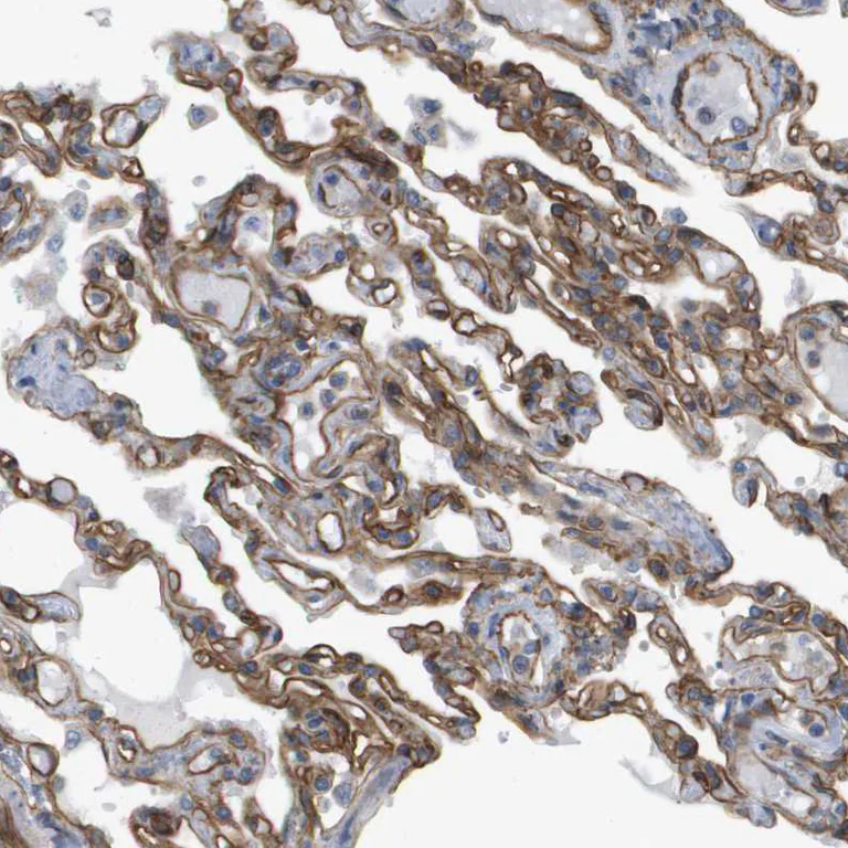 Immunohistochemistry (Formalin/PFA-fixed paraffin-embedded sections) - Anti-Sphingomyelin Synthase 2 antibody (AB272570)