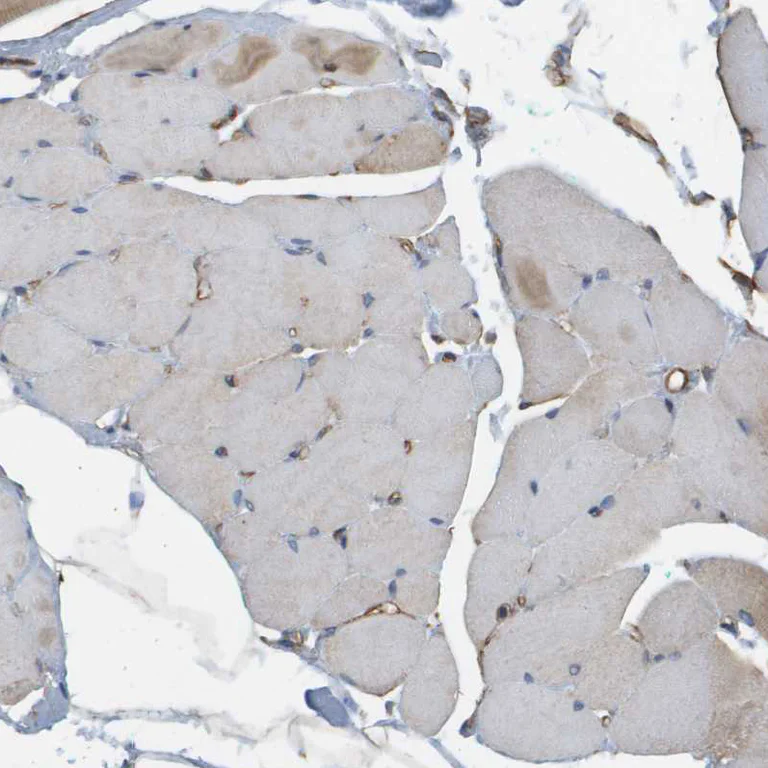 Immunohistochemistry (Formalin/PFA-fixed paraffin-embedded sections) - Anti-Sphingomyelin Synthase 2 antibody (AB272570)