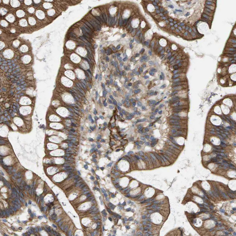Immunohistochemistry (Formalin/PFA-fixed paraffin-embedded sections) - Anti-Sphingomyelin Synthase 2 antibody (AB272570)