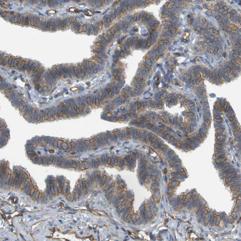 Immunohistochemistry (Formalin/PFA-fixed paraffin-embedded sections) - Anti-Sphingomyelin Synthase 2 antibody (AB272570)