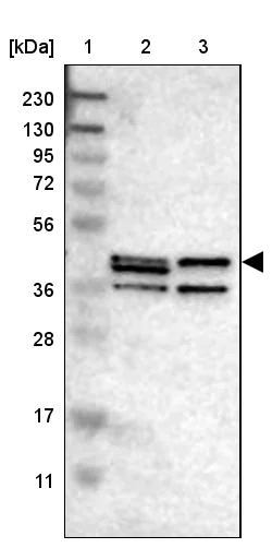 Western blot - Anti-Sphingomyelin Synthase 2 antibody (AB272570)