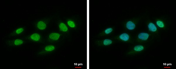 Immunocytochemistry/ Immunofluorescence - Anti-SPHK1 antibody (AB228645), expandable thumbnail