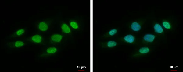 Immunocytochemistry/ Immunofluorescence - Anti-SPHK1 antibody (AB228645)