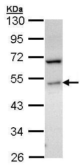Western blot - Anti-SPHK1 antibody (AB228645), expandable thumbnail