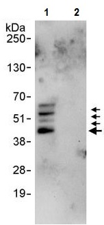 Immunoprecipitation - Anti-SPHK1 antibody (AB245354)