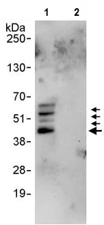 Immunoprecipitation - Anti-SPHK1 antibody (AB245354)