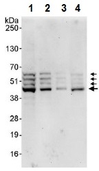Western blot - Anti-SPHK1 antibody (AB245354)