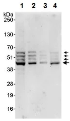 Western blot - Anti-SPHK1 antibody (AB245354)