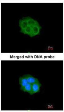Immunocytochemistry/ Immunofluorescence - Anti-SPHK1 antibody (AB262697), expandable thumbnail
