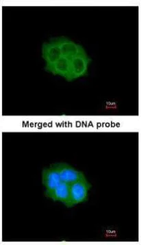 Immunocytochemistry/ Immunofluorescence - Anti-SPHK1 antibody (AB262697)
