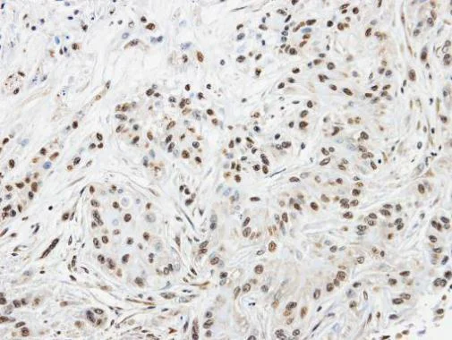 Immunohistochemistry (Formalin/PFA-fixed paraffin-embedded sections) - Anti-SPHK1 antibody (AB262697)