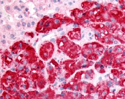 Immunohistochemistry (Formalin/PFA-fixed paraffin-embedded sections) - Anti-SPHK1 antibody (AB61148)