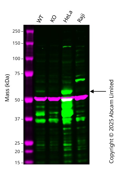 Western blot - Anti-SPHK1 antibody [EPR24511-37] (AB302714)