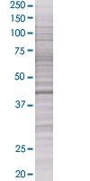 SPHK1 overexpression 293T lysate (whole cell)