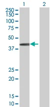 Western blot - SPHK1 overexpression 293T lysate (whole cell) (AB94163)