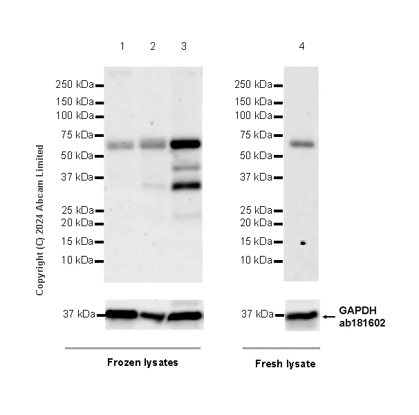 Western blot - Anti-SPHK2 antibody [EPR29189-33] - BSA and Azide free (AB320742)