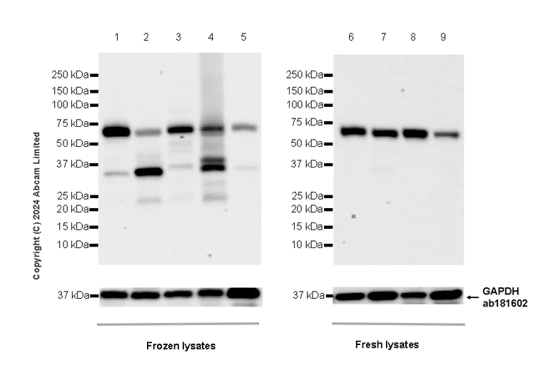 Western blot - Anti-SPHK2 antibody [EPR29189-33] - BSA and Azide free (AB320742)