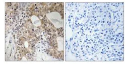 Immunohistochemistry (Formalin/PFA-fixed paraffin-embedded sections) - Anti-SPHK2 (phospho T614) antibody (AB111948)