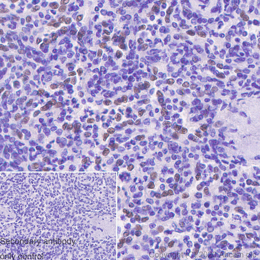 Immunohistochemistry (Formalin/PFA-fixed paraffin-embedded sections) - Anti-SPIB antibody [235D] (AB241570), expandable thumbnail