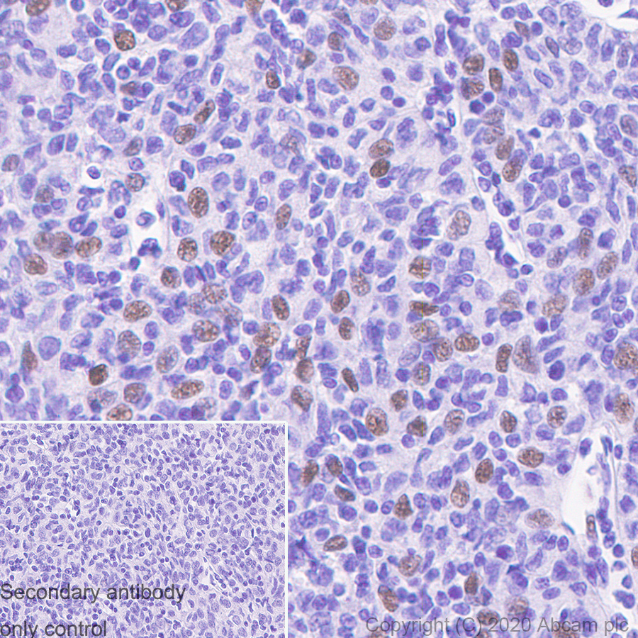Immunohistochemistry (Formalin/PFA-fixed paraffin-embedded sections) - Anti-SPIB antibody [235D] (AB241570), expandable thumbnail