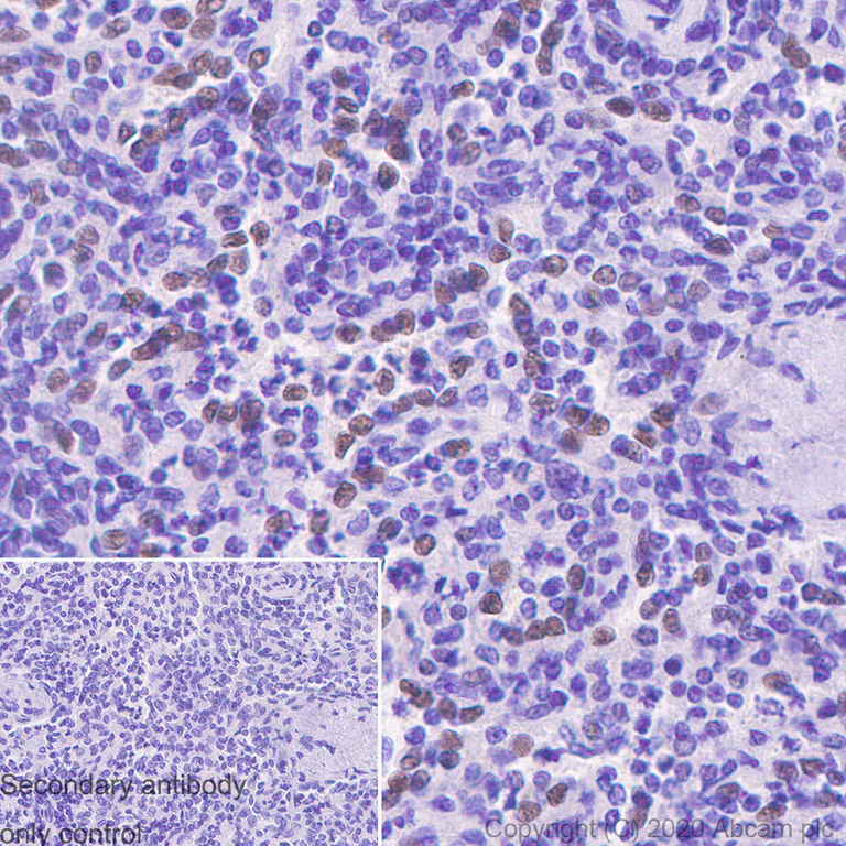 Immunohistochemistry (Formalin/PFA-fixed paraffin-embedded sections) - Anti-SPIB antibody [235D] - BSA and Azide free (AB252783)