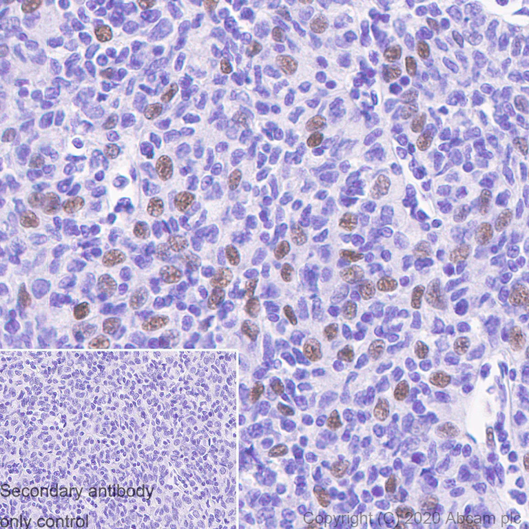 Immunohistochemistry (Formalin/PFA-fixed paraffin-embedded sections) - Anti-SPIB antibody [235D] - BSA and Azide free (AB252783)