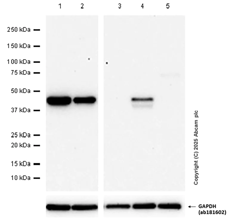 Western blot - Anti-SPIB antibody [EPR26784-117] (AB309346)