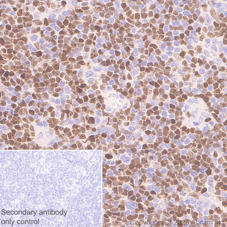 Immunohistochemistry (Formalin/PFA-fixed paraffin-embedded sections) - Anti-SPIB antibody [EPR26784-117] - BSA and Azide free (AB309347)