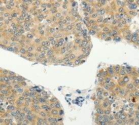 Immunohistochemistry (Formalin/PFA-fixed paraffin-embedded sections) - Anti-SPIN4 antibody (AB197353)